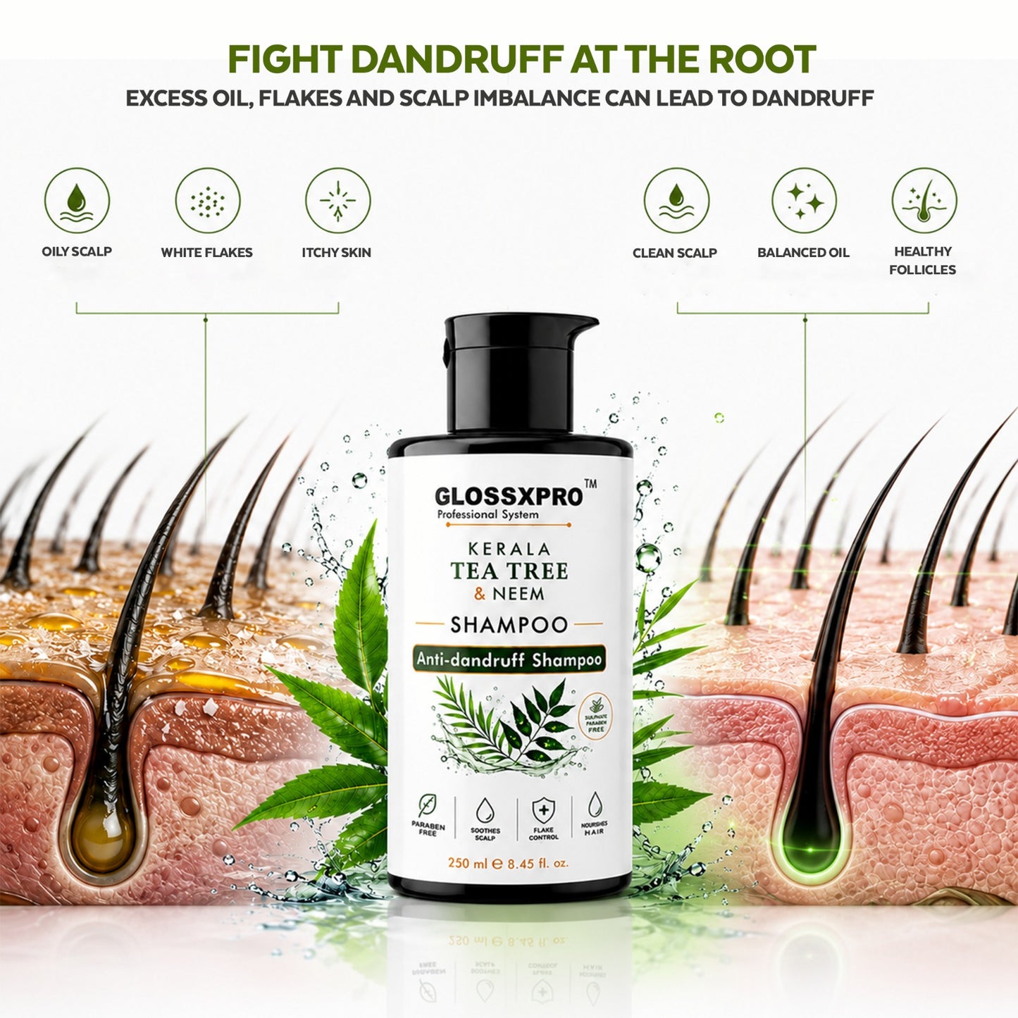 GLOSSXPRO Professional System Kerala Tea Tree & Neem Shampoo | Anti-Dandruff Shampoo | Helps Reduce Flakes & Itchy Scalp | Soothes & Balances Scalp | Paraben Free | 250 ml